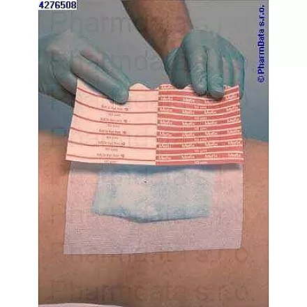 Mocowanie Mefix samoprzylepne 10mx2,5cm 310250